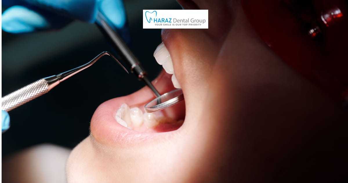 Affordable Wisdom Teeth Removal in Northeast Fresno, CA