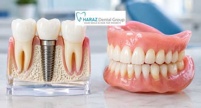 Dental Implants vs. Dentures: Which Is Best for Missing Teeth?