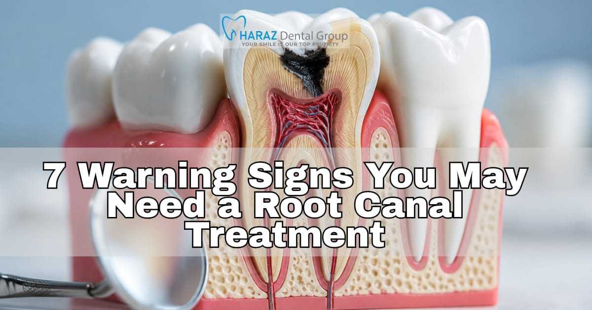 7 Warning Signs You May Need a Root Canal Treatment
