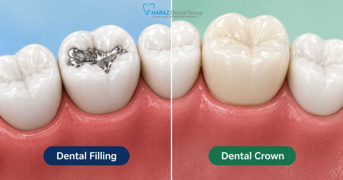 Dental Crown vs Filling: Which Treatment Is Right for Your Tooth?