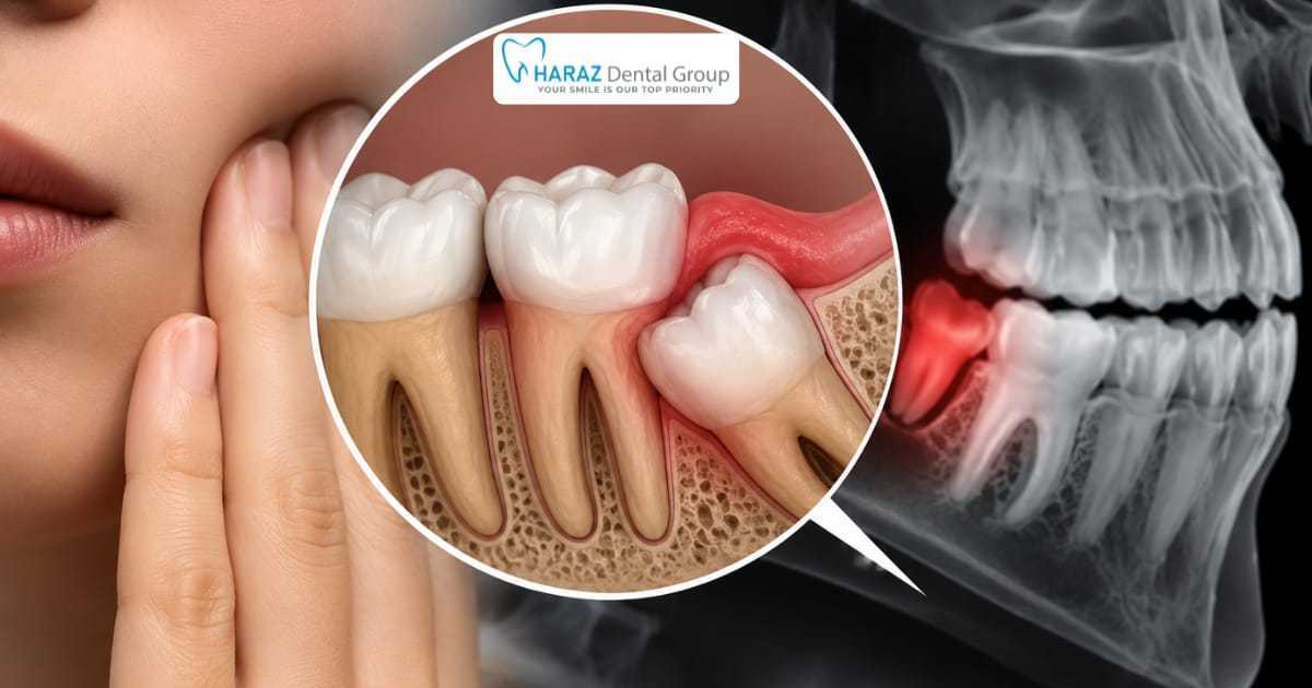 Dentist in Fairmead, CA — Affordable, Medi-Cal & Emergency Dental Care